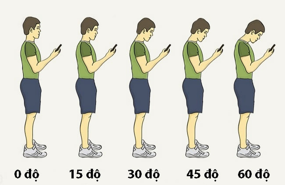 9 cách thông minh để lưng thẳng và đẹp - 3 9 cách thông minh để lưng thẳng và đẹp - 3