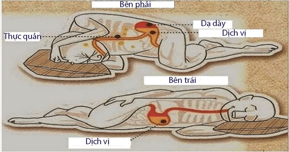 5 bí quyết "nhẹ gánh" dạ dày - 2 5 bí quyết "nhẹ gánh" dạ dày - 2