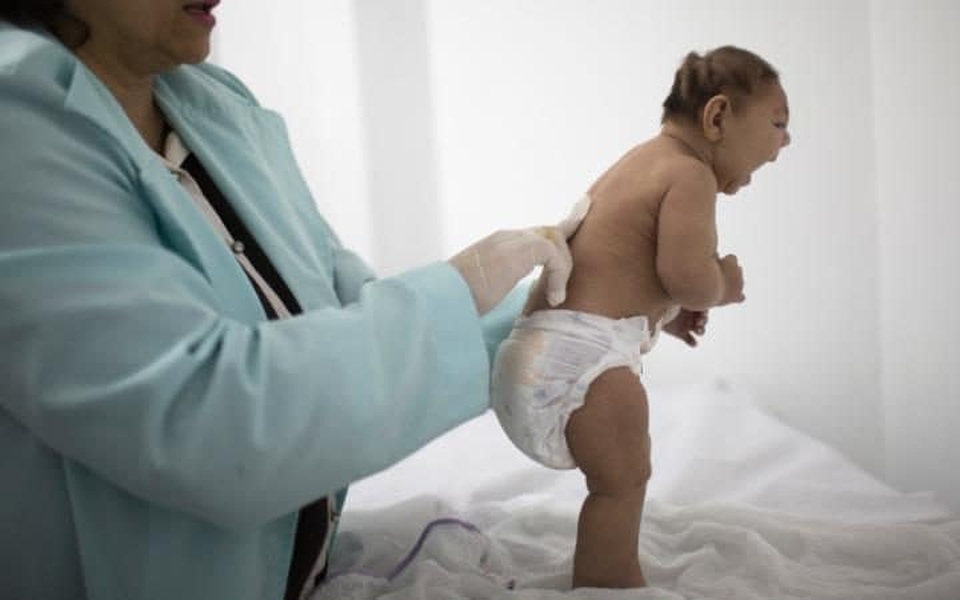 Vi rút Zika có thể là chìa khoá để chống lại khối u não? - 3 Hàng trăm em bé sinh ra với tật đầu nhỏ sau khi Zika bùng phát ở Nam Mỹ
