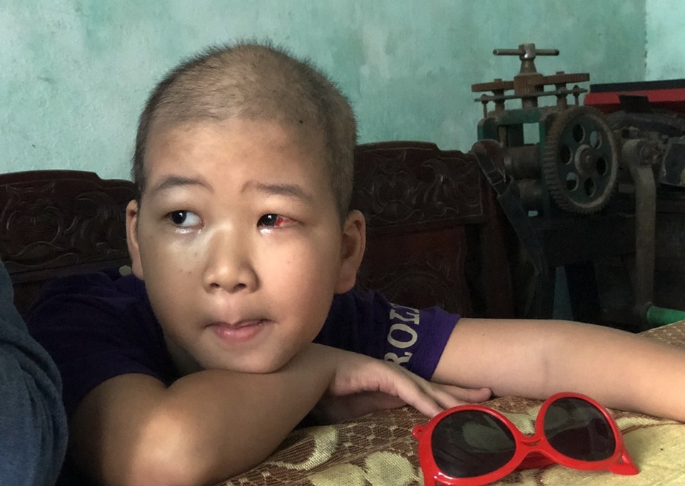 Mẹ khóc hết nước mắt thương con đớn đau vì bệnh ung thư máu - 3 Cháu Huy đang có những ngày hiếm hoi được xuất viện giữa các đợt điều trị. Con muốn được đi học lại. Khi nào tóc con mọc dài ra lại là con được đi học lại - cháu Huy nói