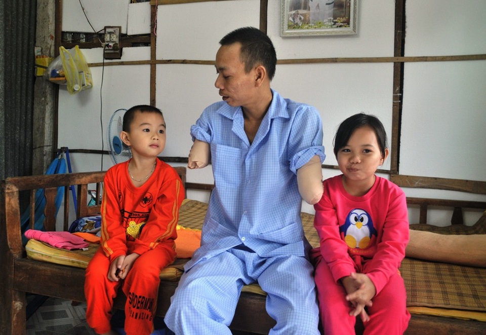 Tình cảnh khốn khó của người đàn ông mất cả 2 tay vì điện giật - 2 Từ người đàn ông trụ cột gia đình, anh Vĩnh trở thành gánh nặng cho gia đình. Anh lo nhất là hai con nhỏ của anh sớm chịu cảnh đói ăn, thất học...