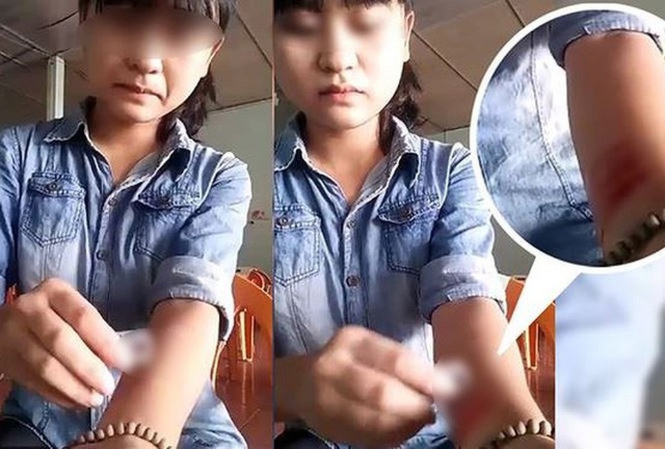 Giới trẻ cắt tay, cạo da: TS Tâm lý Trần Thành Nam nói gì? - 2
Cô gái ở Nghệ An cắt tay ngay sau khi chia tay người yêu.