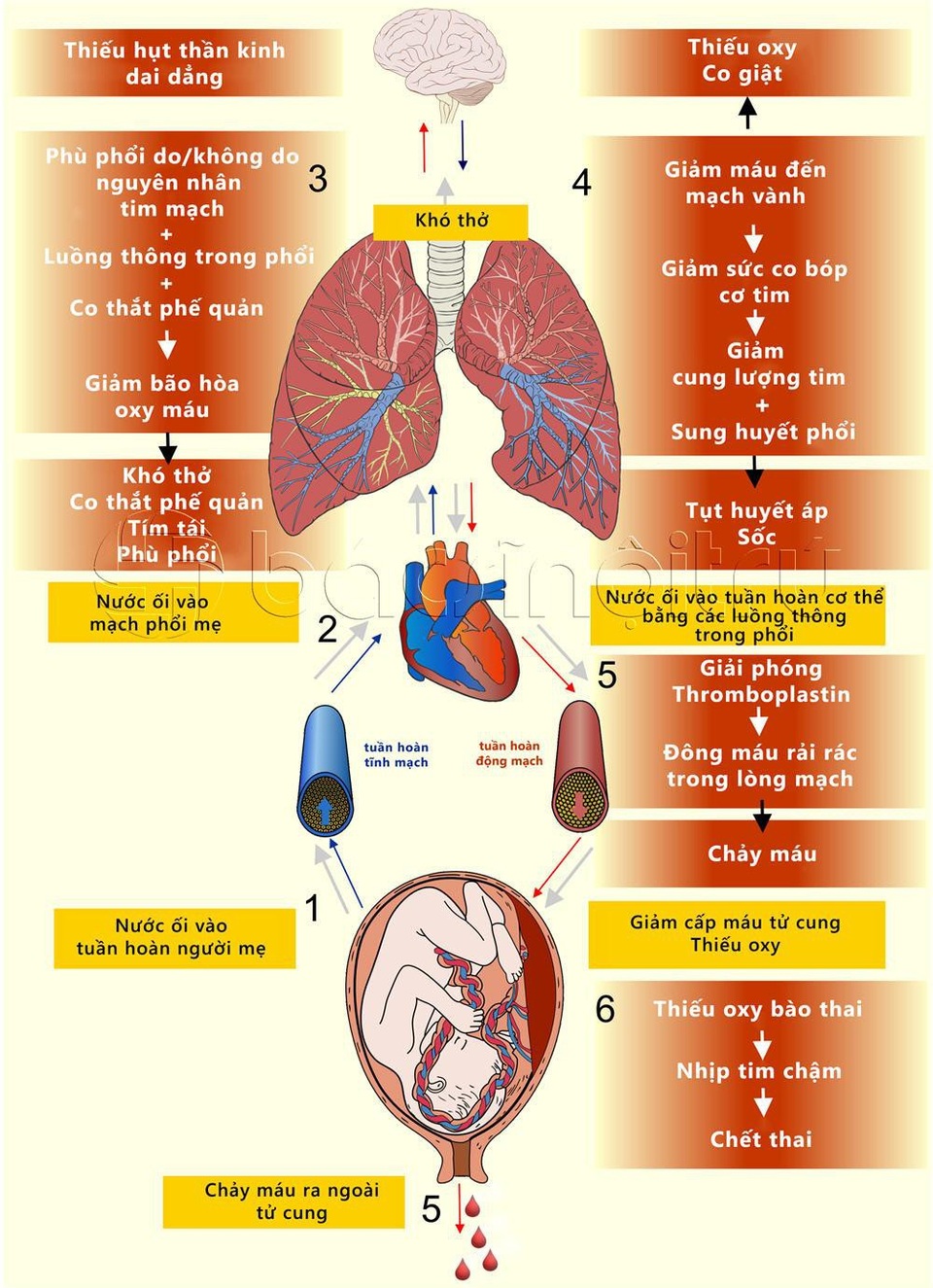 Tắc mạch ối - Biến chứng phụ khoa rất nguy hiểm - 1 Sinh lý biến chứng tắc mạch ối