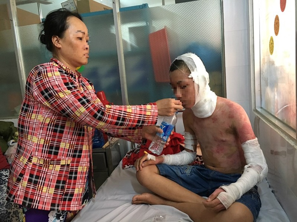 Em N. đang được mẹ chăm sóc tại khoa Bỏng, BV Nhi đồng 1. Ảnh: H.LAN