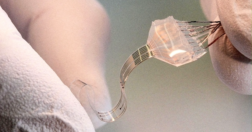 Kích thích điện giúp một người đàn ông liệt chân đi lại được - 2
Kích thích điện giúp người đàn ông bị liệt lấy lại khả năng tự đi lại - Ảnh từ Đại học Bách khoa Liên bang Lausanne.