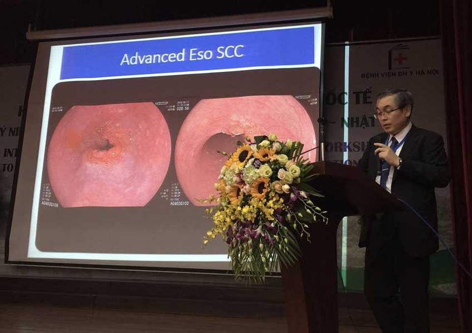Ung thư thực quản: Có thể chẩn đoán sớm đến mức nào? - 1
PGS.TS Ryoji Miyahara, khoa Tiêu hóa Gan mật, ĐH Y khoa Nagoya Nhật Bản, trình bày báo cáo tại Hội nghị Tiêu hóa và Gan mật quốc tế tổ chức tại bệnh viện Đại học Y Hà Nội