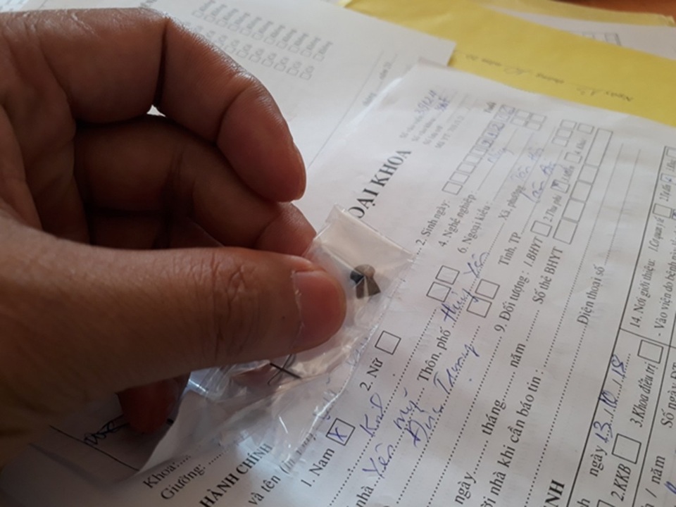 Vụ trúng đạn trong lúc làm vườn: Anh rể thử súng, bắn trúng em vợ - 1 Viên đạn chì được các bác sĩ gắp ra từ người nạn nhân