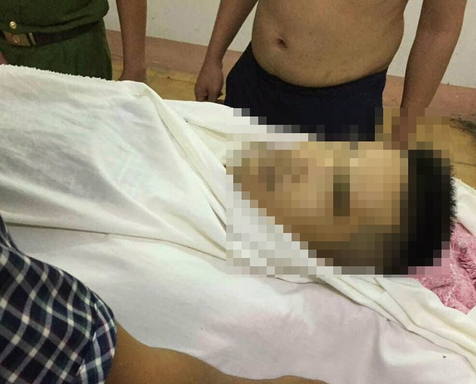 Nghi phạm dùng súng thể thao bắn chết người ra đầu thú - 1
Nạn nhân Nguyên tử vong sau phát đạn của nghi phạm Lê Hoàng Anh.