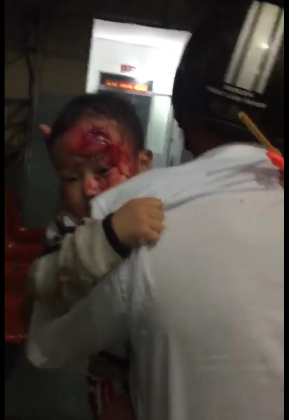 Gia đình cháu bé bức xúc khi con trai bị thương nhưng bác sĩ lại không có ở khoa để trực khám (ảnh cắt từ clip)