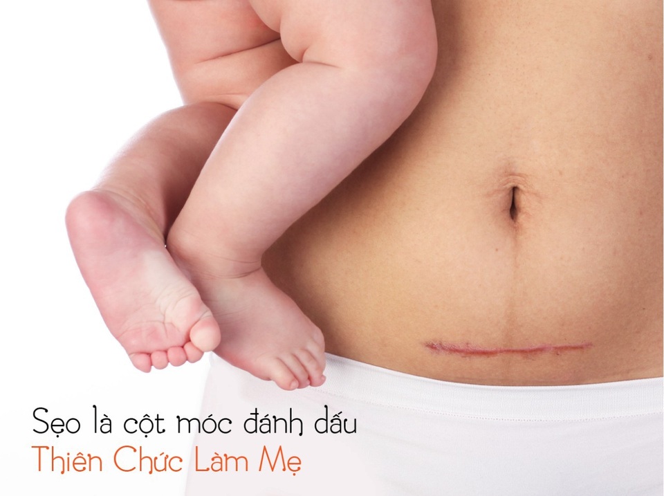 Bí quyết xua tan nỗi lo về sẹo - 1 Bí quyết xua tan nỗi lo về sẹo - 1