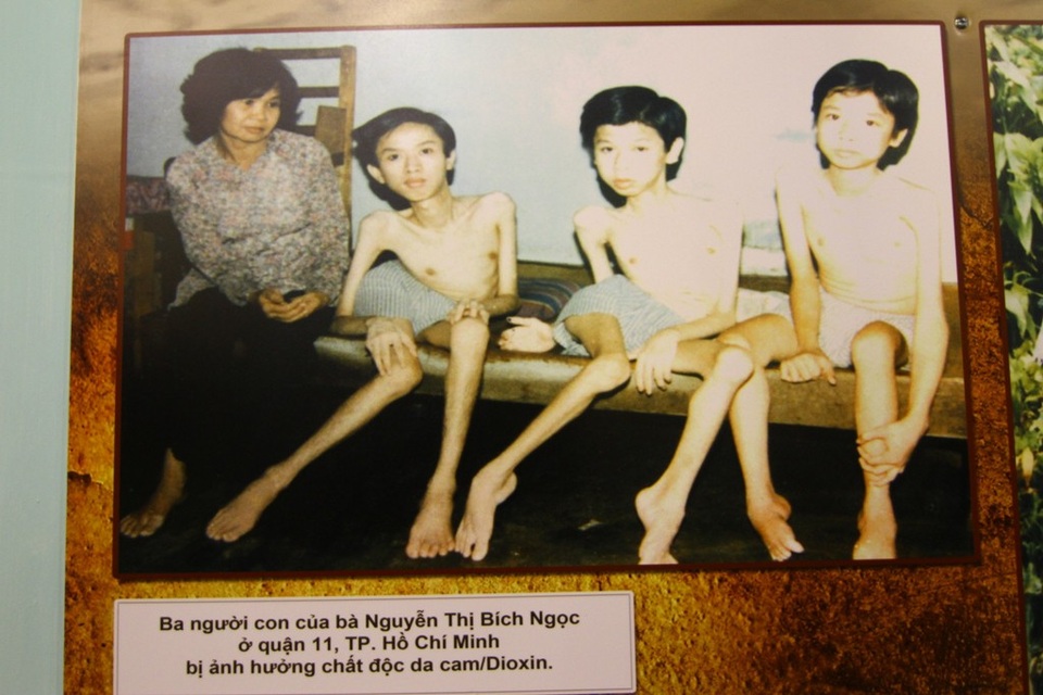 Da cam - Lương tri và công lý - 6 Người mẹ Nguyễn Thị Bích Ngọc (quận 11, TP Hồ Chí Minh) bên 3 người con đều bị ảnh hưởng chất độc da cam/đioxin