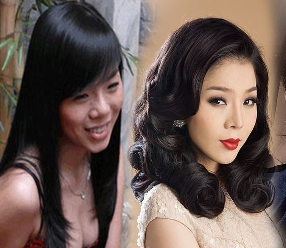 Lệ Quyên là nghệ sĩ hiếm hoi ở showbiz Việt thừa nhận từng phẫu thuật thẩm mỹ. Nữ ca sĩ cho biết mũi thấp là khuyết điểm ngoại hình khiến cô kém tự tin. Theo chia sẻ từ quản lý truyền thông của Lệ Quyên, cô đã sửa mũi gần 10 năm.