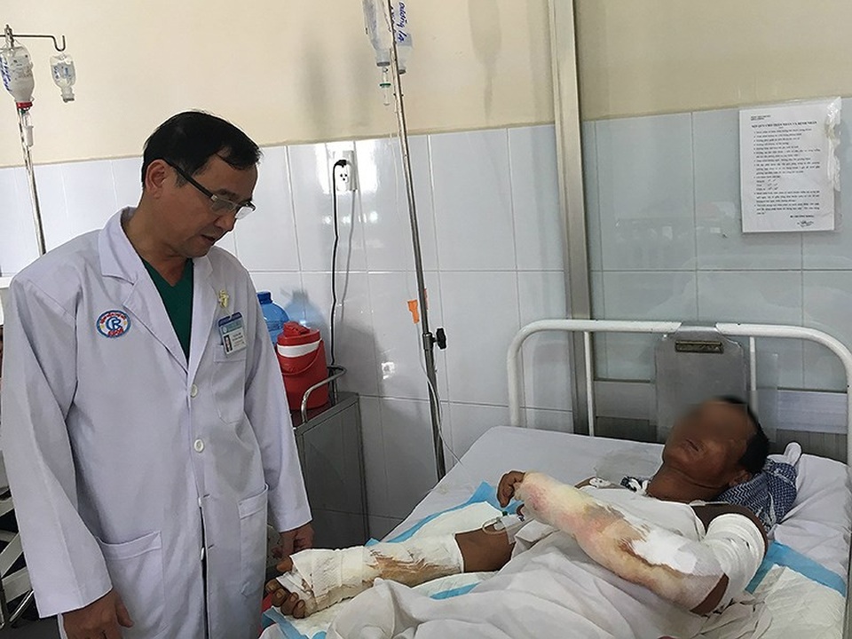 Hàng trăm số phận bị hủy hoại do tai nạn phỏng điện - 1 Anh Lê Hoàng D. đang điều trị tại khoa Phỏng-Tạo hình, BV Chợ Rẫy, TP.HCM. Ảnh: HL
