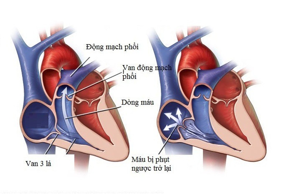 7. Lời khuyên về lối sống và phòng ngừa