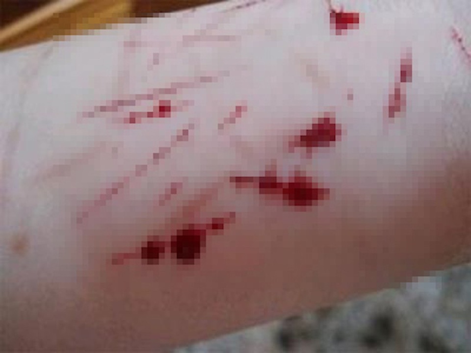 Nhiều học sinh khá, giỏi lại có xu hướng thực hiện các hành vi tự huỷ hoại bản thân (ảnh minh hoạ)