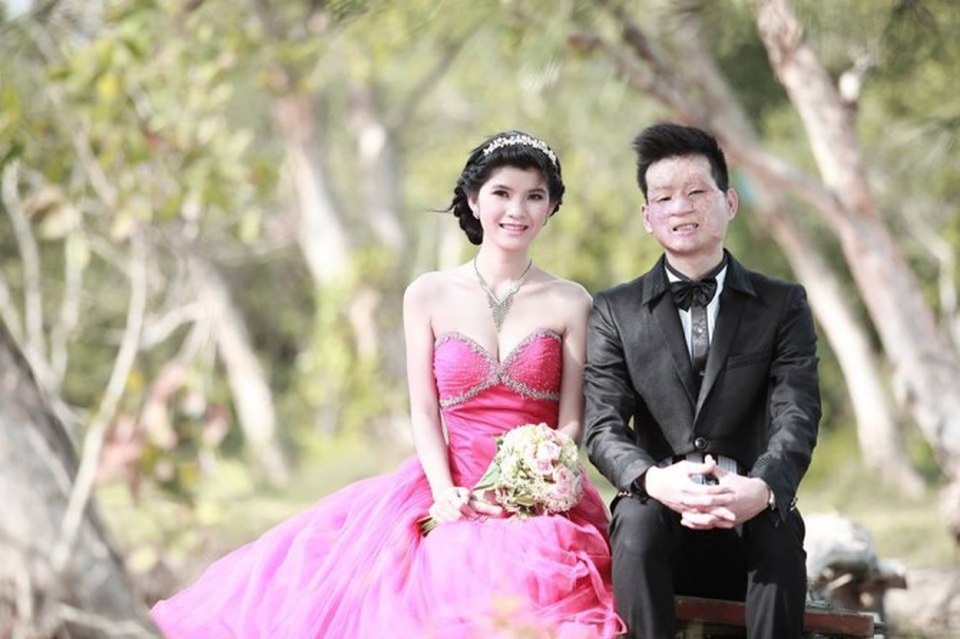 Cuộc sống của cặp đôi “chồng xấu, vợ xinh” sau 4 năm kết hôn, giờ ra sao? - 8 Trước đó, chuyện tình của cặp đôi được mệnh danh là “chồng xấu, vợ xinh” ở TP. Hồ Chí Minh từng gây xôn xao dư luận do sự chênh lệch ngoại hình.