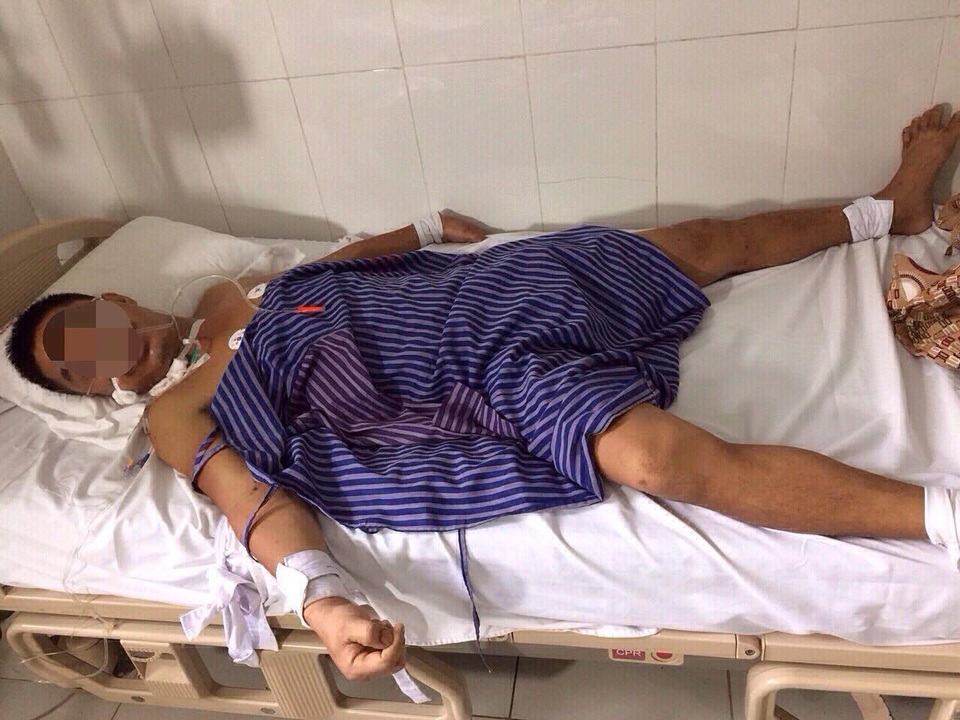 Bệnh viện đa khoa Lạng Sơn tiếp nhận bệnh nhân và điều trị loạn thần phải buộc chặt tay, chân để kiểm soát hành vi tấn công người khác.