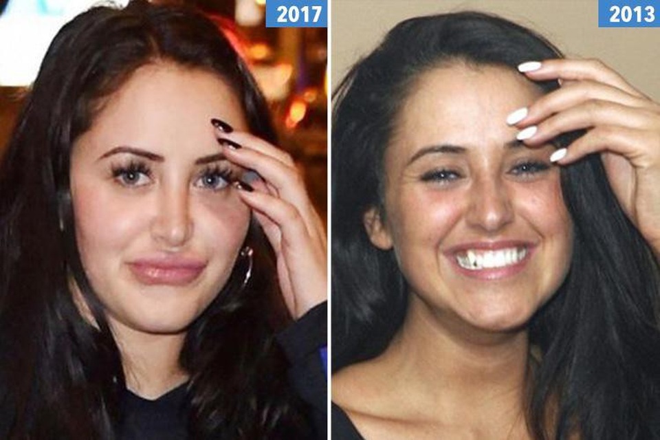 Marnie Simpson tái xuất sau tin đồn đại tu "vòng ba" - 7
Marnie Simpson thậm chí đã tuyên bố sẽ dừng việc phẫu thuật thẩm mỹ sau khi bị nhiều fans chê bai hình ảnh ngày càng cứng và kém tự nhiên