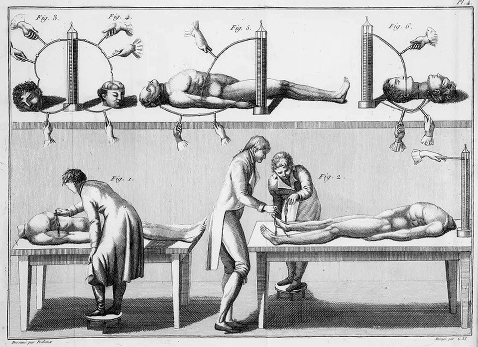 Frankenstein: Những thí nghiệm có thật đã truyền cảm hứng cho khoa học viễn tưởng - 1
Các thí nghiệm của Giovanni Aldini với xác chết của con người.