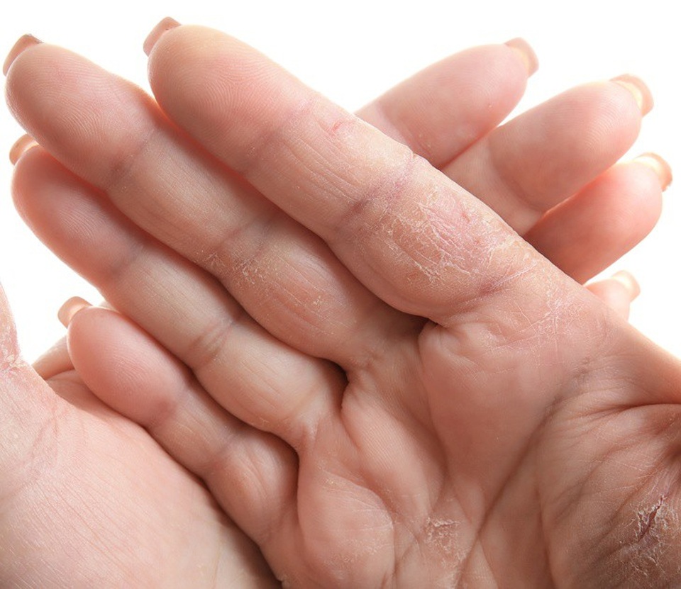 Cần chú ý khi cơ thể xuất hiện 10 dấu hiệu lạ dưới đây - 7 Cần chú ý khi cơ thể xuất hiện 10 dấu hiệu lạ dưới đây - 7