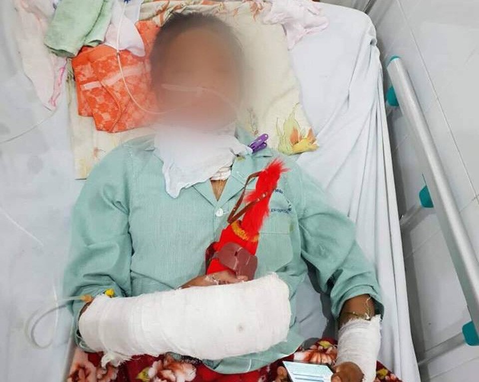 Bé gái 14 tuổi bị cắt cổ, cưỡng hiếp phải chuyển lên Hà Nội cấp cứu - 1 Bé gái 14 tuổi bị cắt cổ, cưỡng hiếp phải chuyển lên Hà Nội cấp cứu - 1