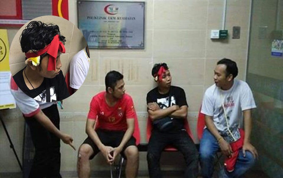 
CĐV Myanmar bị tấn công ở Malaysia
