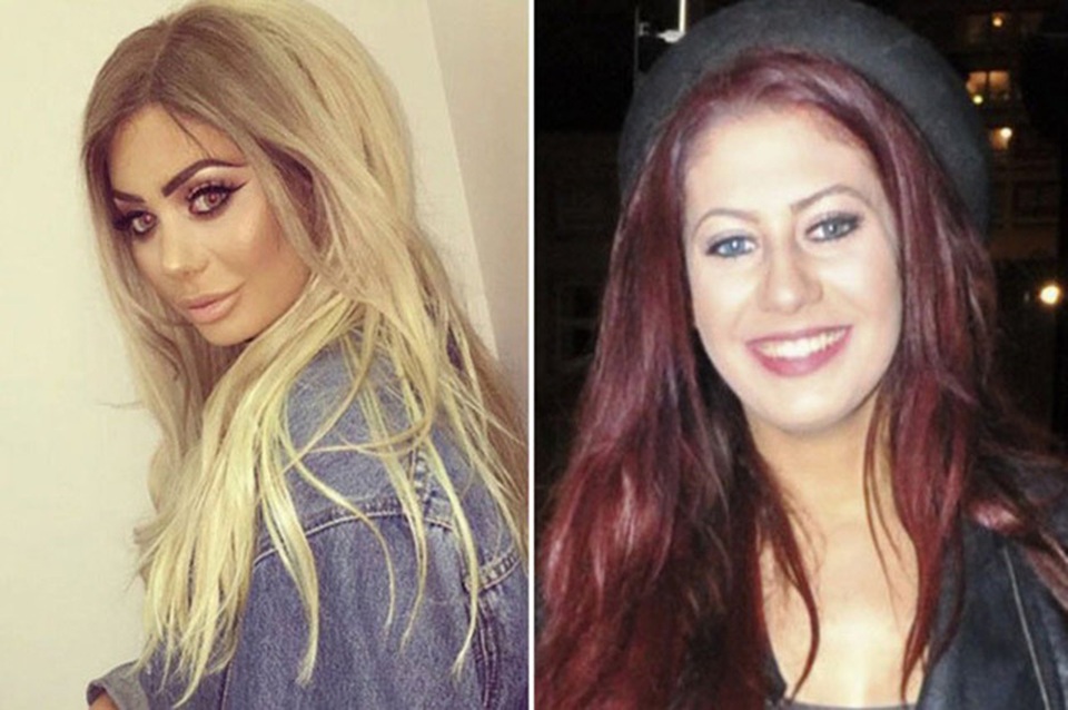 Gương mặt cứng đơ của sao "nghiện dao kéo" Chloe Ferry - 6
Ferry bắt đầu mê đại tu nhan sắc từ năm 19 tuổi, cô khởi đầu bằng việc sửa mũi và bơm môi