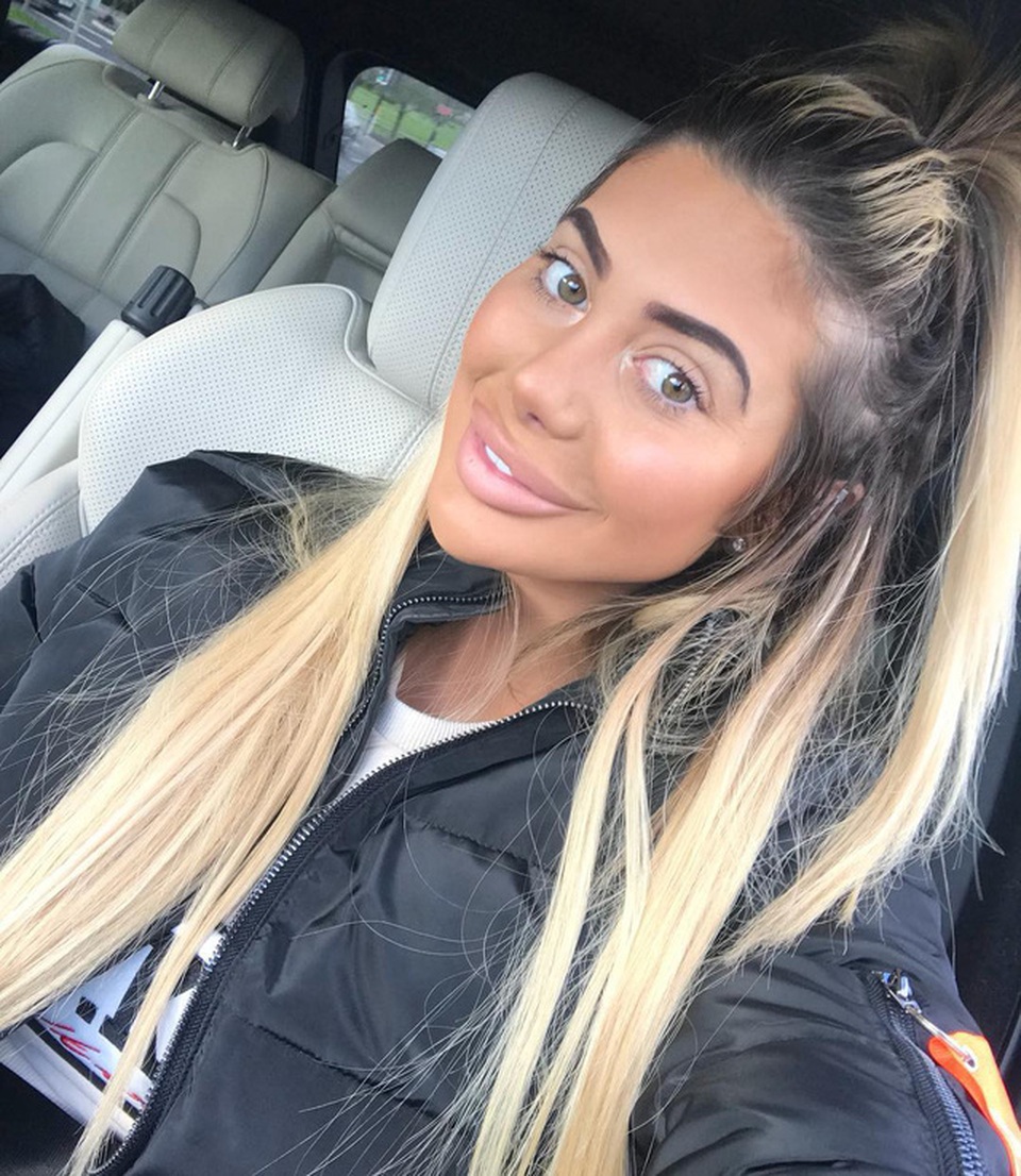 Gương mặt cứng đơ của sao "nghiện dao kéo" Chloe Ferry - 8
Chloe ừng chia sẻ cô bị rối loạn chức năng cơ thể nên luôn mong muốn được phẫu thuật thẩm mỹ