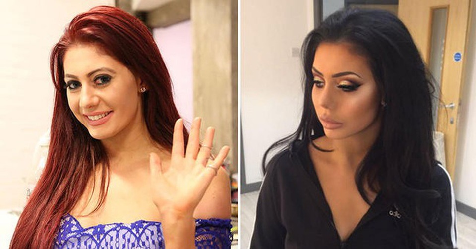 Gương mặt cứng đơ của sao "nghiện dao kéo" Chloe Ferry - 7
Chloe Ferry (trái) - trước khi chỉnh sửa nhan sắc trông tự nhiên hơn nhiều