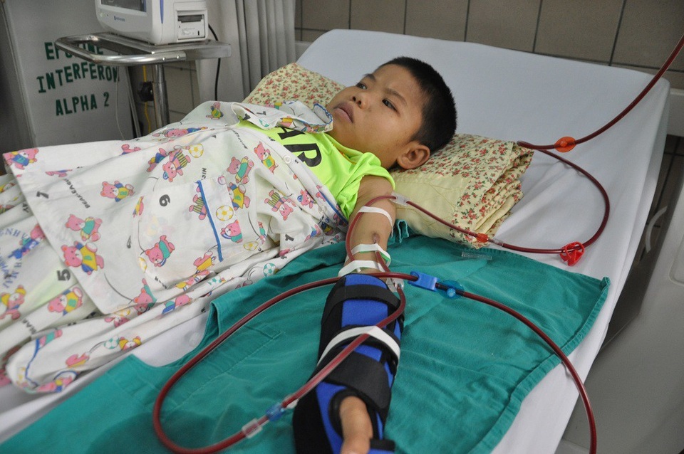 Em bị gãy bên tay chạy cầu thận.