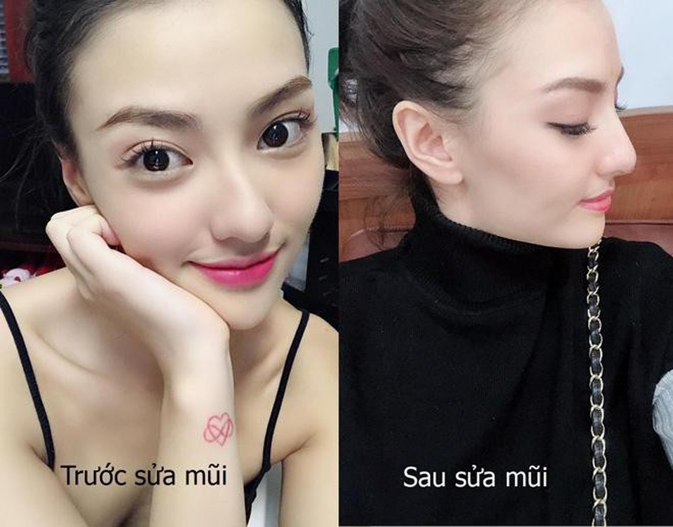 Hồng Quế công khai chuyện làm mũi, cho rằng “mũi gồ vất vả tình duyên” - 1 Ít ngày trước, Hồng Quế bất ngờ công khai trên trang cá nhân: Và em đã có một chiếc mũi mới. Ưng quá mọi người ạ. Trước mũi em gồ và xấu lắm, chỉ được cái cao thôi, giờ mới là đẹp xuất sắc này. Mũi em bây giờ còn ưng và đẹp hơn gấp 100.000 lần ngày trước.