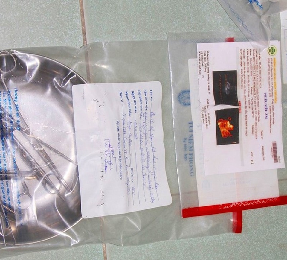 Dụng cụ phá thai thu được tại cơ sở của bà Lâm. Ảnh: CA