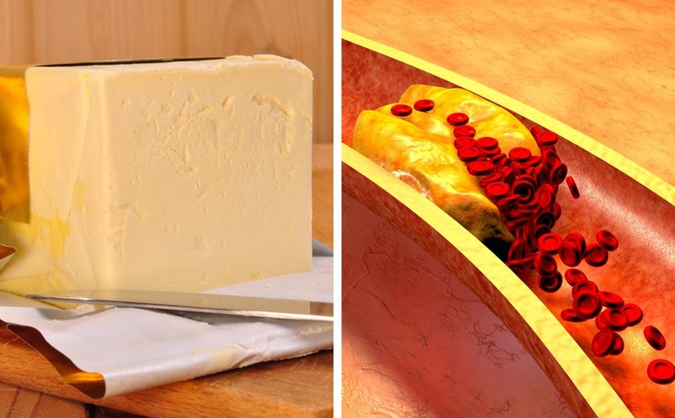 9 yếu tố gây mất cân bằng nội tiết tố - 8 9 yếu tố gây mất cân bằng nội tiết tố - 8