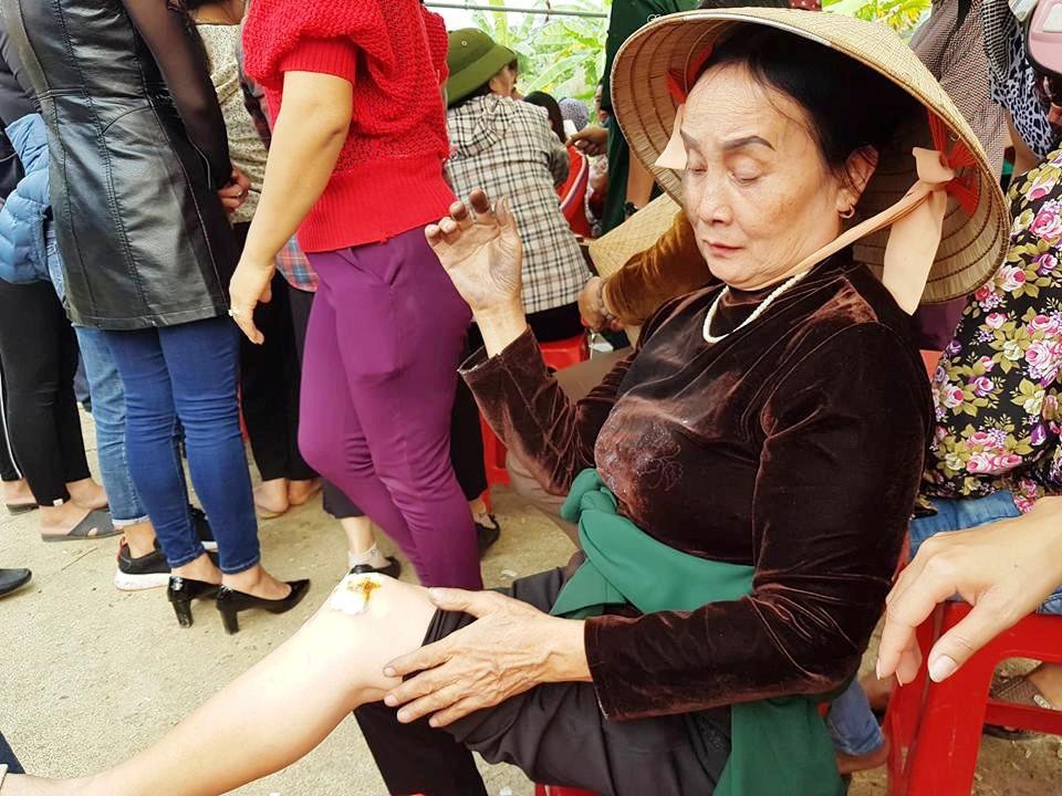 Ninh Bình: Tạm dừng xây dựng đài hóa thân nhiều “tai tiếng” bị dân phản đối! - 2 Người của doanh nghiệp đưa đến triển khai dự án xô xát với người dân làm nhiều người bị thương phải đi bệnh viện chưa trị.