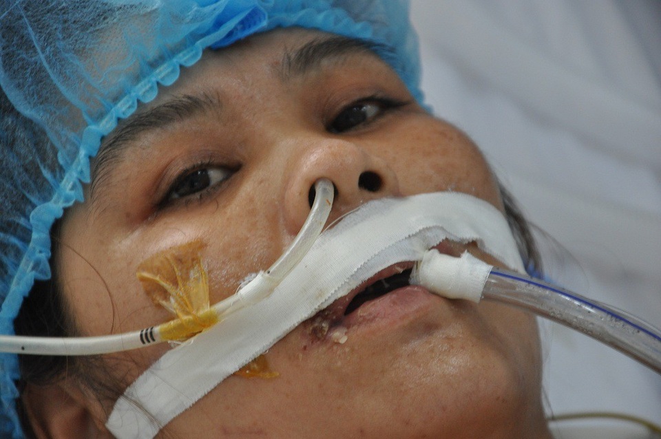 Bị tường đổ vào, người phụ nữ trẻ vỡ tim, nguy kịch tính mạng - 5 Chị mở mắt nhìn chúng tôi đau đáu như cầu xin sự giúp đỡ.