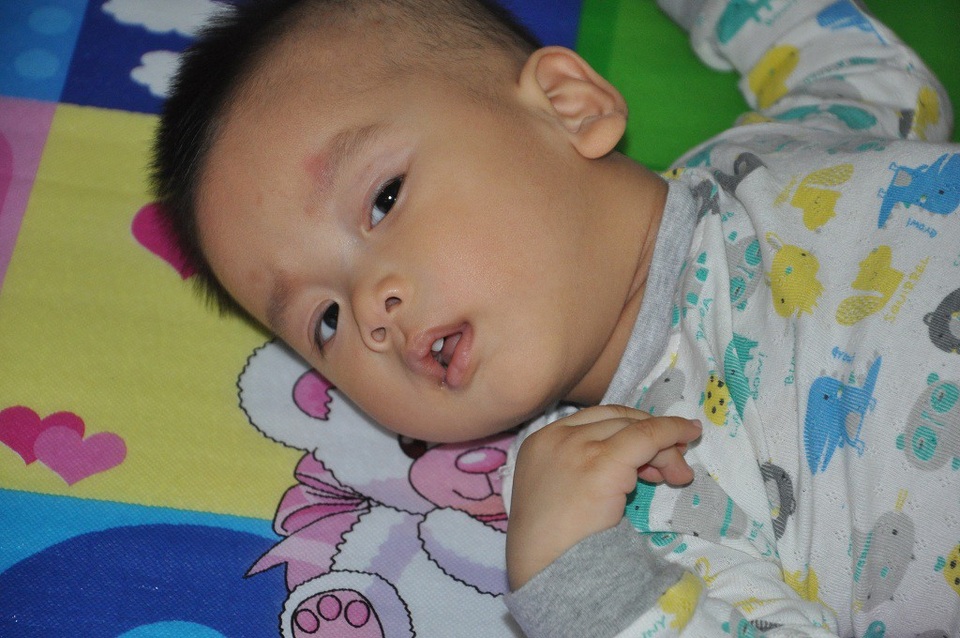 Cậu bé Long Nhật đang được điều trị ở bệnh viện Nhi TW.