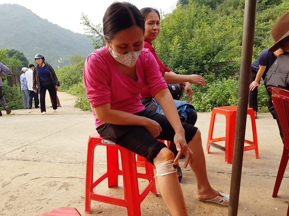 Doanh nghiệp xây đài hóa thân lúc nửa đêm, dân đốt đuốc phản đối - 6 Chị Vân bị thương sau khi bị nhóm vệ sĩ do Công ty TNHH Việt Đức thuê đến xô ngã.