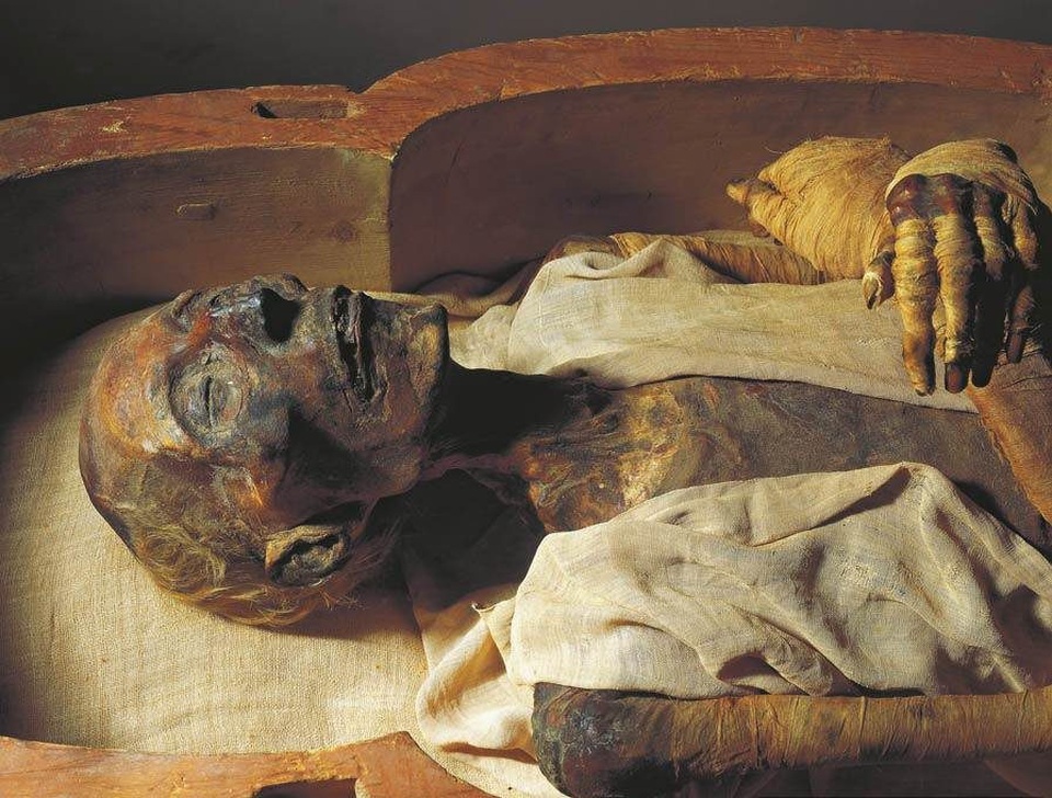 Những bí mật về xác ướp Pharaoh duy nhất được cấp hộ chiếu “du lịch” sang Pháp - 3 Xác ướp được du lịch sang Pháp để kiểm tra và điều trị