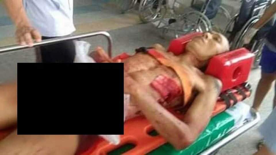 Dùng dao rọc giấy tự cắt “của quý” sau khi bị nhiều cô gái từ chối - 2 Reawat Petnui, 41 tuổi, được đưa vào bệnh viện sau khi tự cắt của quý