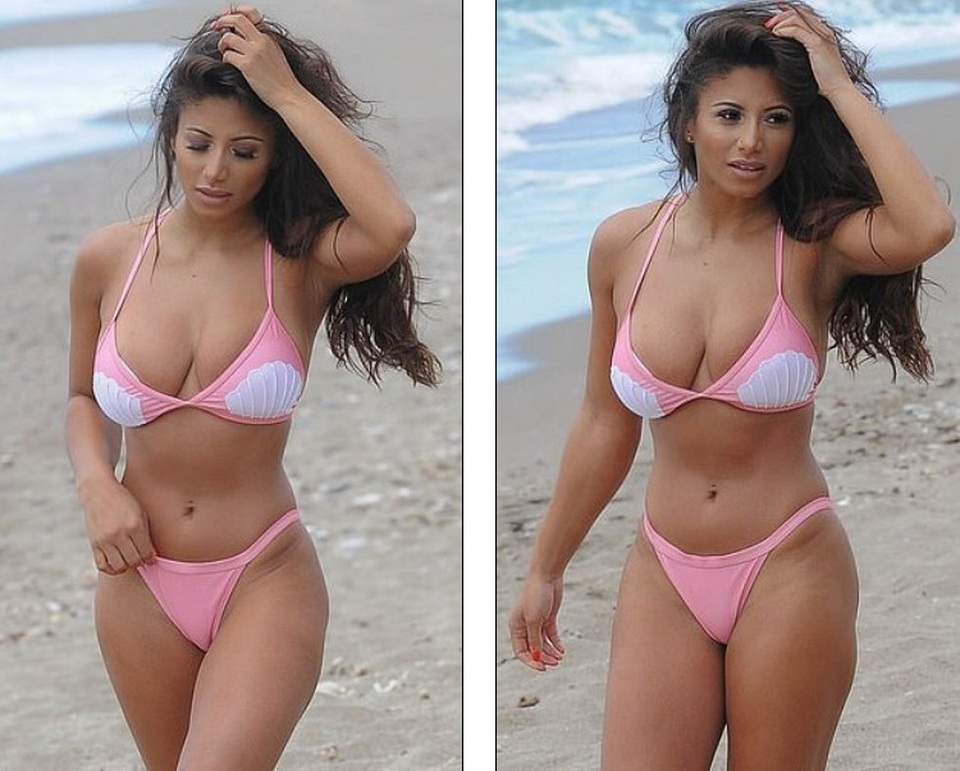 
Cô nói mình cảm thấy tự tin hơn nhiều sau ca phẫu thuật này
