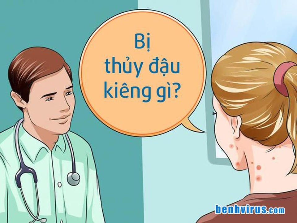 Người bị bệnh thủy đậu kiêng gì cho nhanh khỏi? - 1 Những điều người bị thủy đậu nên kiêng và ghi nhớ nếu muốn bệnh nhanh khỏi