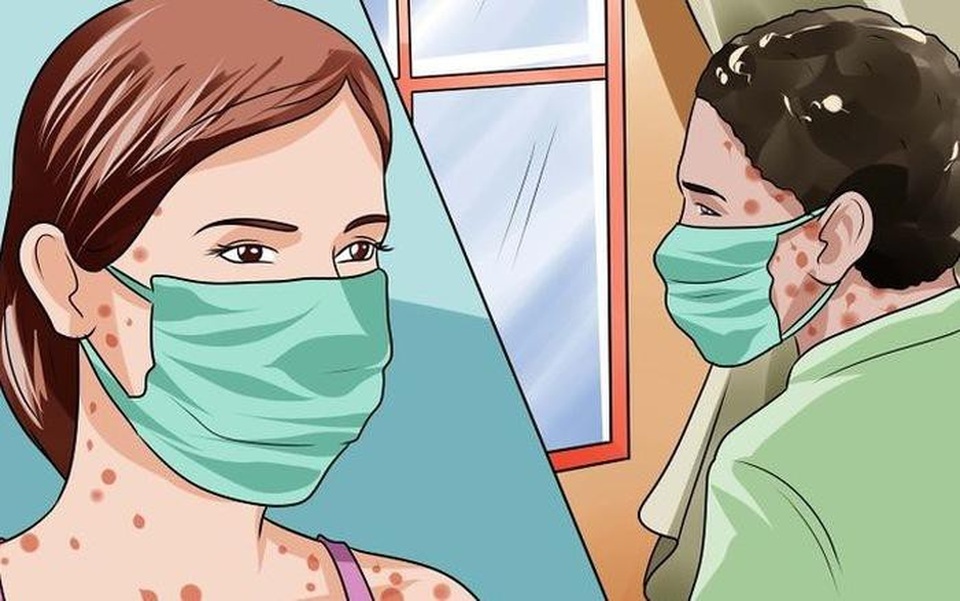 Người bị bệnh thủy đậu kiêng gì cho nhanh khỏi? - 3 Người bị thủy đậu cần hạn chế tới chỗ đông người để giảm thiểu nguy cơ lây bệnh