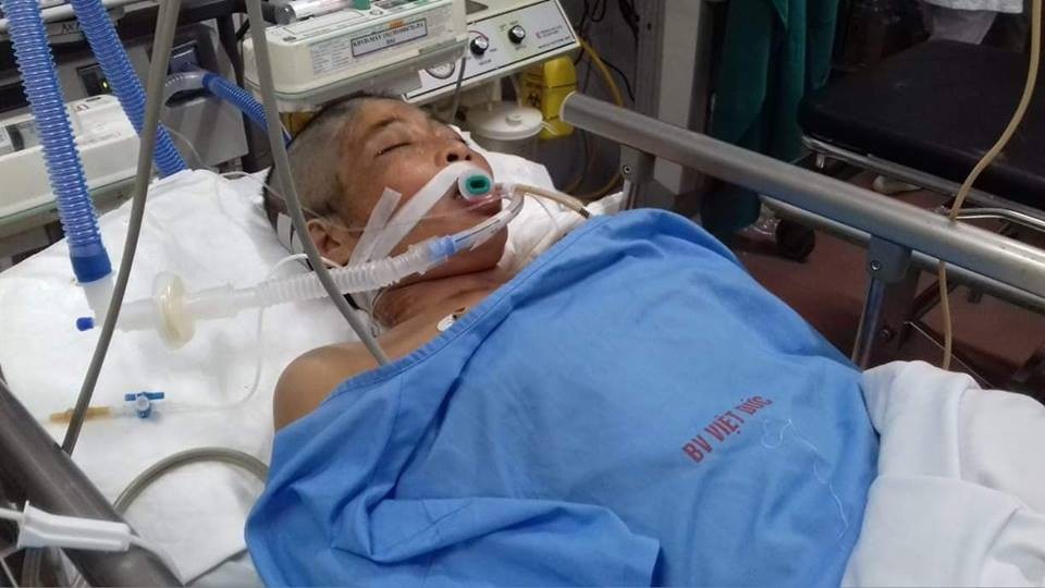 Cặp vợ chồng thợ hồ bị xe bồn tông thương vong - 1 Chị Liên đang rất nguy kịch tại bệnh viện Việt Đức.