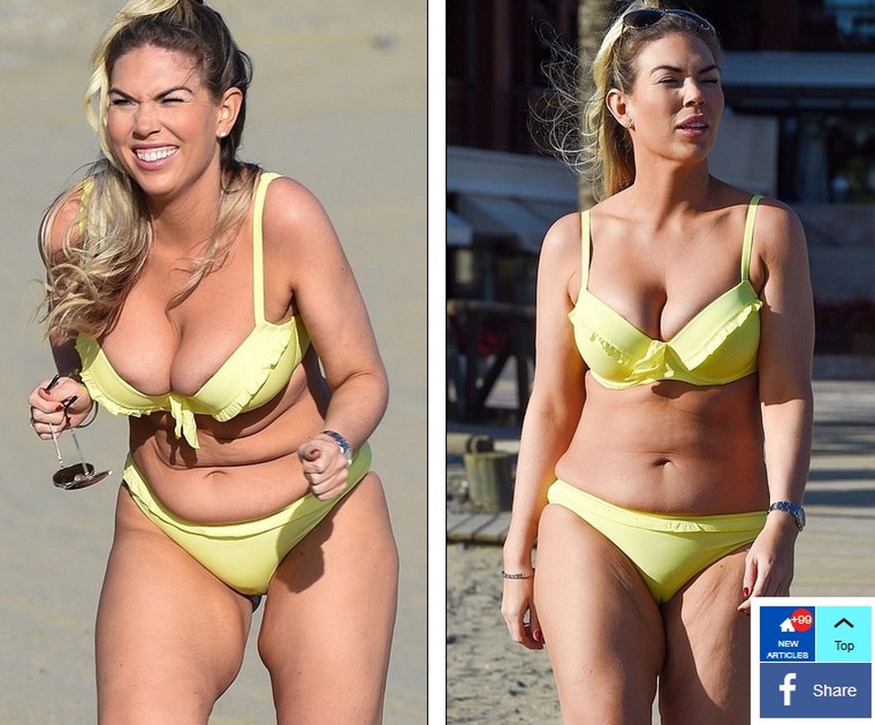 Giảm cân sốc, Frankie Essex lộ da nhăn nheo - 2
Frankie Essex từng tiết lộ bị chứng rối loạn trong cơ thể nên rất dễ tăng cân. Cô phải nỗ lực rất nhiều để giảm cân và làm biến mất bụng mỡ