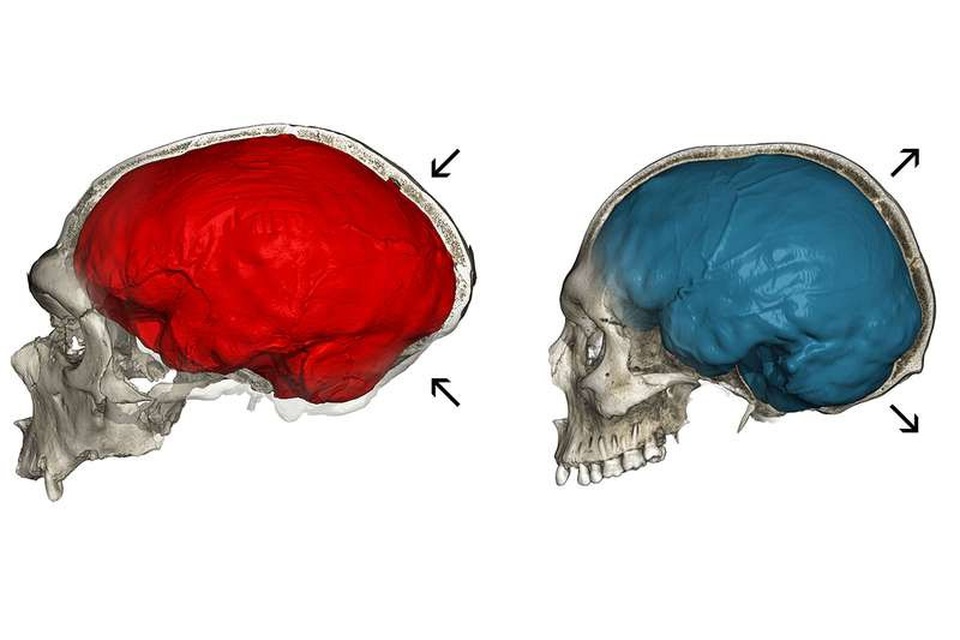 Những người đầu hơi bẹp là do gen di truyền của người Neanderthal - Ảnh 2. Những người đầu hơi bẹp là do gen di truyền của người Neanderthal - Ảnh 2.