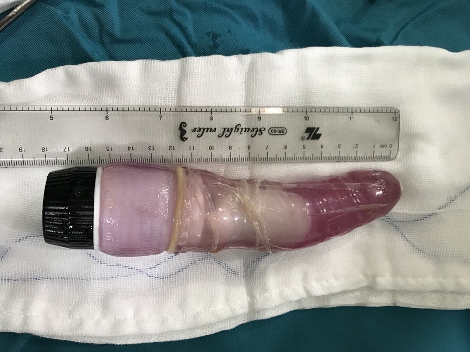 Dương vật “khủng” kẹt trong hậu môn nam thanh niên - 2 Chiếc dương vật khủng dài 18cm được nam thanh niên dùng để tự sướng rồi gặp nạn