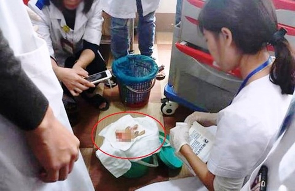 Chủ quán phở bị chém đứt bàn tay vì mâu thuẫn với người lái xe ôm - 1 Các bác sĩ tiến hành nối lại bàn tay cho nạn nhân.