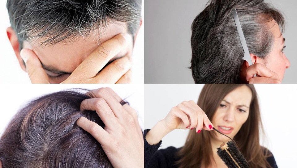 “Cải lão hoàn đồng”  cùng thực phẩm bảo vệ sức khỏe Hoàn Xuân Thang - 1 Tóc bạc, tóc rụng, lão hóa sớm có phải là vấn đề của bạn?