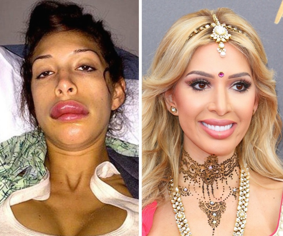 Farrah Abraham khoe vòng một dao kéo - Ảnh 9. Farrah Abraham khoe vòng một dao kéo - Ảnh 9.