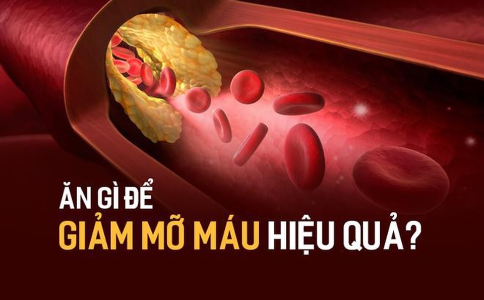 Mỡ máu, mỡ gan ăn thế nào để “tiêu” mỡ nhanh? - Ảnh 1.